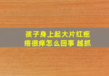 孩子身上起大片红疙瘩很痒怎么回事 越抓